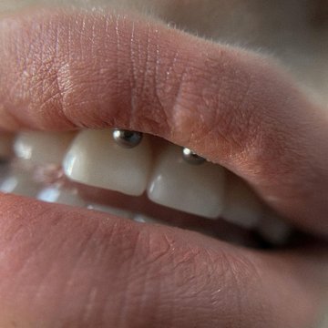 Smiley Piercing