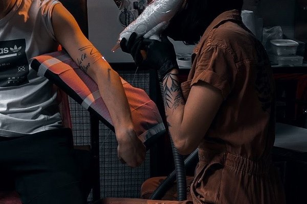 Laser tattoo removal in Vancouver