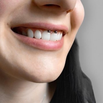 Smiley Piercing