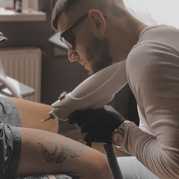 Laser tattoo removal in Vancouver
