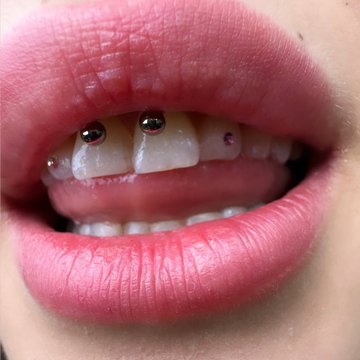 Smiley Piercing